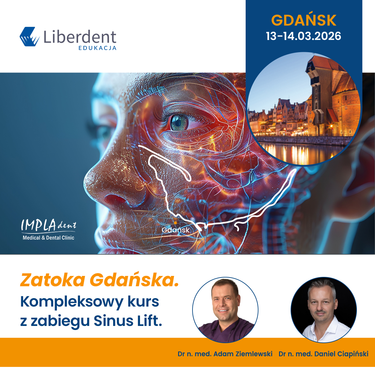 Zatoka Gdańska. Kompleksowy kurs z zabiegu Sinus Lift.